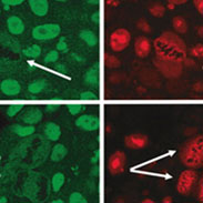 A Flood of Testosterone Stops Prostate Cancer Cell Division