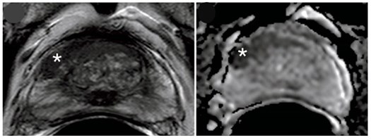 Multi Parametric Mri Full