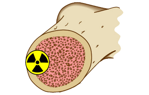 Combining radium-223 (Xofigo) with Abiraterone (Zytiga) is not recommended