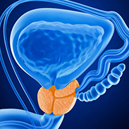 Current imaging trends for prostate cancer diagnosis